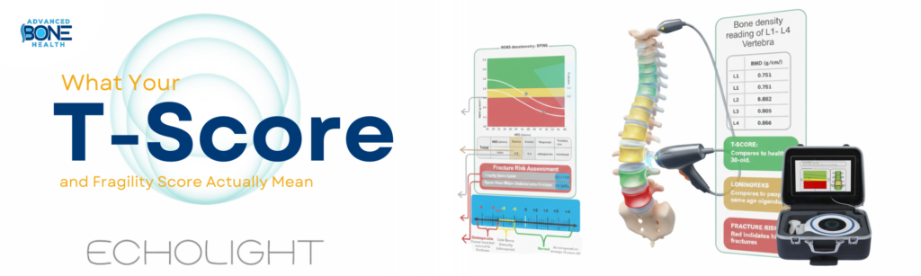 What your T-Score mean