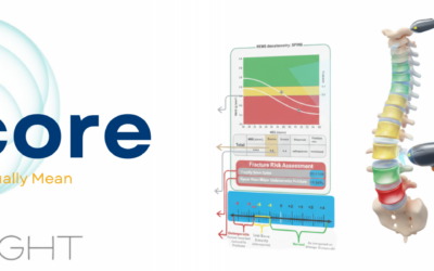 Bone Density Report Guide: T-Score vs Fragility Score