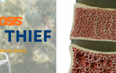 Osteoporosis “Silent Thief”: Early Detection REMS Bone Scans